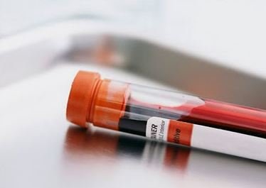 Oddaj próbkę krwi w Staszicu - możesz być dawcą szpiku kostnego