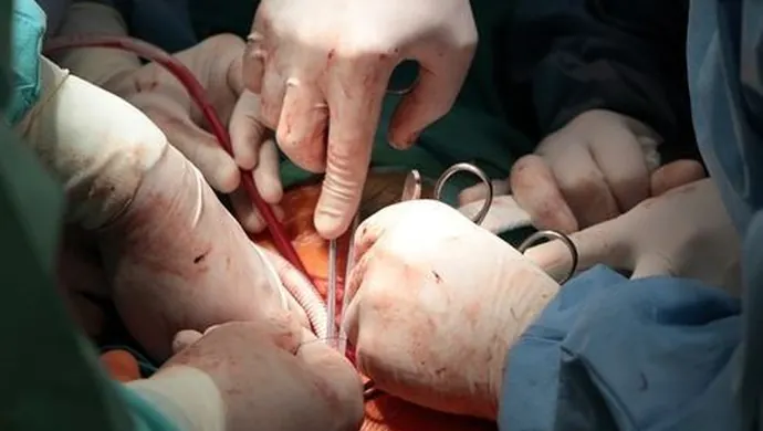 Wrocławscy lekarze uratowali życie 24-letniemu mieszkańcowi Wschowy