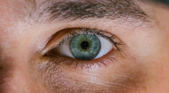 Jakie są znane sposoby na pozbycie się zmarszczek pod oczami?