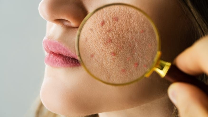 Dermatolog w Krakowie: Twoja Skóra w Bezpiecznych Rękach