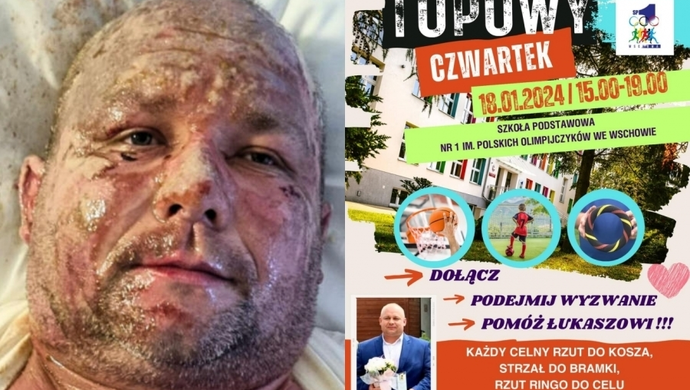 Przyjdź i pomóż Łukaszowi Topie. SP 1 organizuje „Topowy Czwartek”