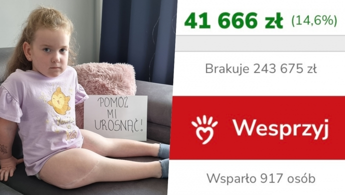 Trwa wyścig z czasem o zdrowie małej Lilianki. Potrzeba ponad 240 tys. zł