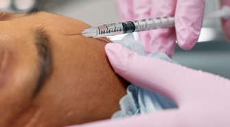 Mezoterapia igłowa – rewolucyjna metoda regeneracji skóry